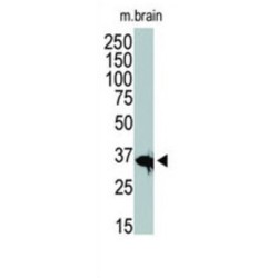 Histone Deacetylase 11 (HDAC11) Antibody