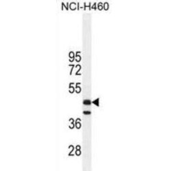 Fibrinogen Like Protein 2 (FGL2) Antibody