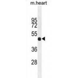 Fibrinogen Like Protein 2 (FGL2) Antibody