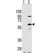 Elongator Acetyltransferase Complex Subunit 3 (ELP3) Antibody