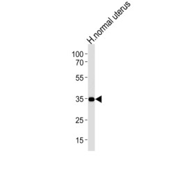 CUB And Zona Pellucida-Like Domain-Containing Protein 1 (CUZD1) Antibody