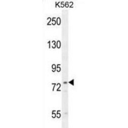 Urocanate Hydratase (UROC1) Antibody