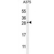 Methyl-CpG-Binding Domain Protein 3-Like 2 (MBD3L2) Antibody