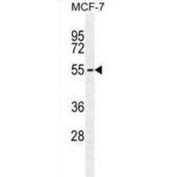 Mitochondrial-Processing Peptidase Subunit Alpha (PMPCA) Antibody