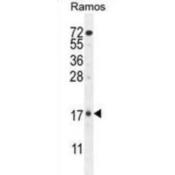 Tetratricopeptide Repeat Protein 9C (TTC9C) Antibody