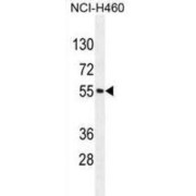 Mesoderm Induction Early Response Protein 2 (MIER2) Antibody