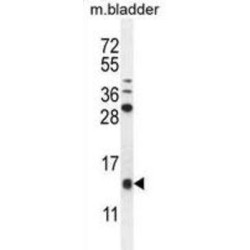 KTAP2 Antibody