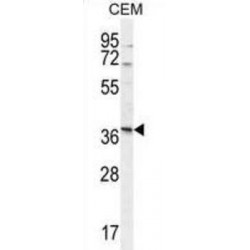 Neurexophilin 4 (NXPH4) Antibody