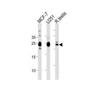 Growth Factor, Augmenter of Liver Regeneration (GFER) Antibody