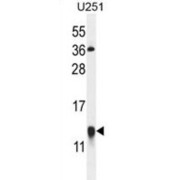 GLT Antibody