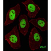 Protein Lin-28 Homolog A (LIN28A) Antibody