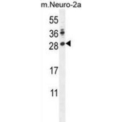 Protein Lin-28 Homolog A (LIN28A) Antibody