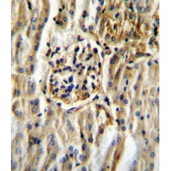 Cytochrome P450 11B2 (CYP11B2) Antibody