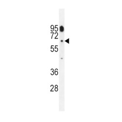 Cytochrome P450 11B2 (CYP11B2) Antibody