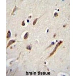 F-Box And WD Repeat Domain Containing 11 (FBXW11) Antibody