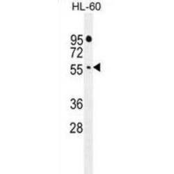 F-Box And WD Repeat Domain Containing 11 (FBXW11) Antibody