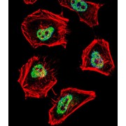 Nuclear Receptor Corepressor 1 (NCOR1) Antibody