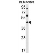 Homeobox Protein Hox-D13 (HOXD13) Antibody