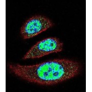 ETS1-Associated Protein II (EAPII) Antibody