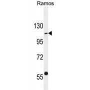 GRB10-Interacting GYF Protein 1 (GIGYF1) Antibody