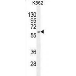 Keratin, Type II Cytoskeletal 73 (KRT73) Antibody