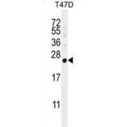 G Antigen 12B/C/D/E (GAGE12B) Antibody