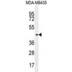 Olfactory Receptor 2L13 (OR2L13) Antibody