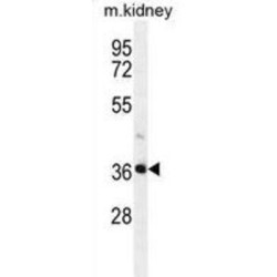 PIH1 Domain-Containing Protein 2 (PIH1D2) Antibody