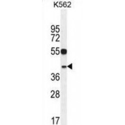 YOD1 Deubiquitinase (YOD1) Antibody