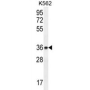 ETS Translocation Variant 2 (ETV2) Antibody