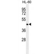 Nuclear Receptor Subfamily 6 Group A Member 1 (NR6A1) Antibody