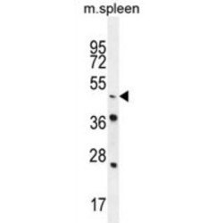 Nuclear Receptor Subfamily 6 Group A Member 1 (NR6A1) Antibody