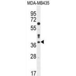 Caspase 3 (CASP3) Antibody