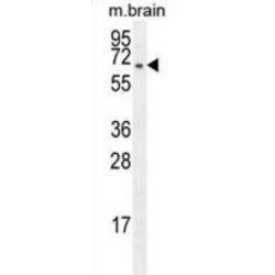 F-Box Only Protein 21 (FBXO21) Antibody