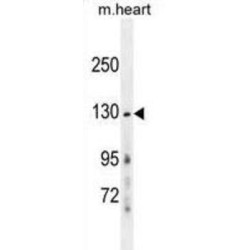 Glutamate Receptor Ionotropic, NMDA 2A (GRIN2A) Antibody