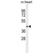 AP-1 Complex Subunit Mu-1 (AP1M1) Antibody