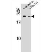 RAB12, Member RAS Oncogene Family (RAB12) Antibody