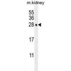 DNA-Directed RNA Polymerase III Subunit RPC7-Like (POLR3GL) Antibody