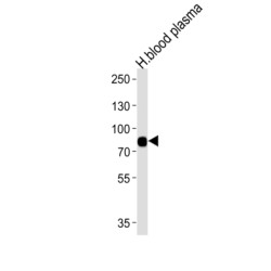 Leucine Rich Repeat Containing 45 (LRRC45) Antibody