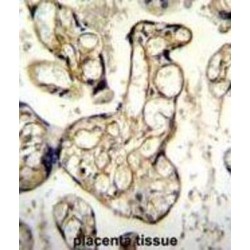Endothelin 1 (EDN1) Antibody