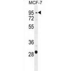 Patched Domain-Containing Protein 3 (PTCHD3) Antibody