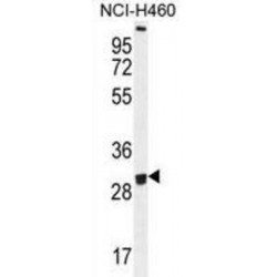 Olfactory Receptor 2B11 (OR2B11) Antibody