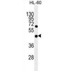 Lysophospholipase D GDPD1 (GDPD1) Antibody