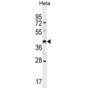 Olfactory Receptor Family 10 Subfamily H Member 4 (OR10H4) Antibody