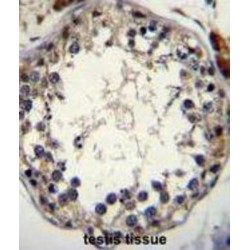 Stimulated By Retinoic Acid 8 (STRA8) Antibody