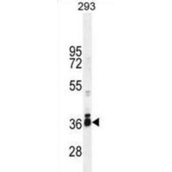 Stimulated By Retinoic Acid 8 (STRA8) Antibody