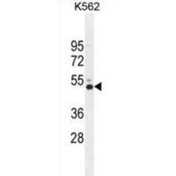 Corticotropin-Releasing Factor Receptor 2 (CRFR2) Antibody