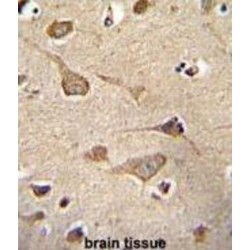 Kinase Suppressor of Ras 2 (KSR2) Antibody