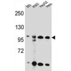 Kinase Suppressor of Ras 2 (KSR2) Antibody