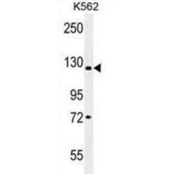 Jumonji Domain-Containing Protein 2C (JMJD2C) Antibody